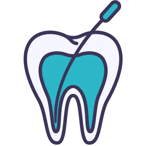 root canal