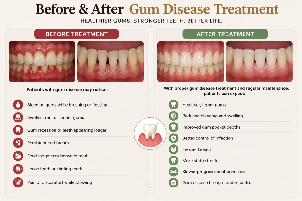 Gum Disease Treatment Results in Harlur