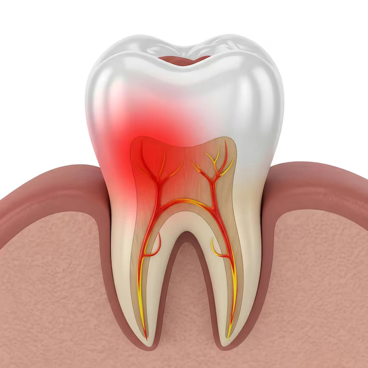 Gum Disease Treatment in Harlur